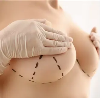 Breast Procedures