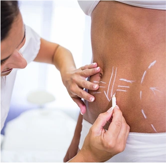 Body Contouring